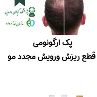 پک ضد ریزش و رویش مجدد بیز