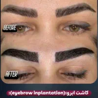 کاشت ابرو|خدمات آرایشگری و زیبایی|اندیشه, اندیشه فاز ۱|دیوار