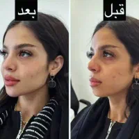 ژل و بوتاکس  قسطی