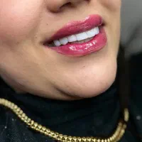 کامپوزیت دندان جشنواره