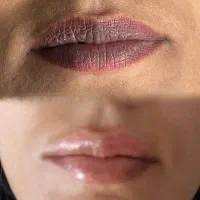 رفع تیرگی دائمی لب (فقط آقایان)|خدمات آرایشگری و زیبایی|اهواز, سپیدار|دیوار
