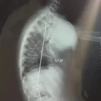 فیزیوتراپی وکاردرمانی درمطب ودرمنزل با ۵۰درصدتخفیف