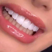 سلامت دندان مهمترین عنصر آراستگی صورت|خدمات آرایشگری و زیبایی|کرمان, |دیوار