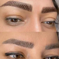 ریموو پاک کردن تتو تیره و تتو قدیمی