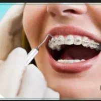 راهنمایی ارتودنسی