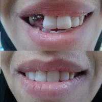 دندانپزشک قسطی بدون پیش پرداخت کلیه خدمات|خدمات آرایشگری و زیبایی|اصفهان, دشتستان|دیوار