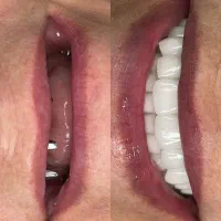 دندانپزشکی ایمپلنت روکش ارتودنسی اقساطی