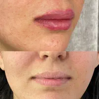 خدمات و آموزش تخصصی پوست و زیبایی|خدمات آرایشگری و زیبایی|شیراز, ارم|دیوار