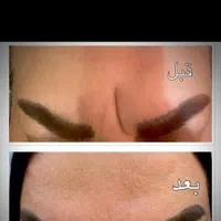 فیلر وژل وبوتاکس|خدمات آرایشگری و زیبایی|تهران, کیانشهر|دیوار