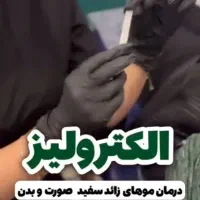 الکترولیز برای همیشه از شر موهای سفید خلاص شوید|آرایشی، بهداشتی، درمانی|ایلام, |دیوار