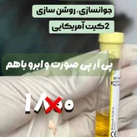 پی ارپی و مزو|خدمات آرایشگری و زیبایی|خوی, |دیوار