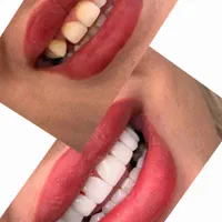 آموزش دندانپزشکی مبحث درمانی