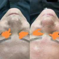 تخفیفات فیشال به مناسب روز دختر از1تیرتا 10تیر