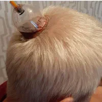 حجامت، درمان چسبندگی عصب دست، کبد چرب|خدمات آرایشگری و زیبایی|زاهدان, |دیوار