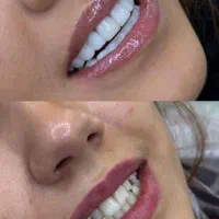 دندانپزشکی|خدمات آرایشگری و زیبایی|قم, دورشهر|دیوار