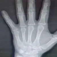 گیرمال و ماساژ درمانی و شکسته بندی