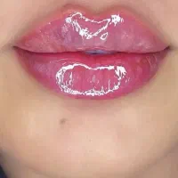 ژل‌  هر سی سی ۳۵۰بوتاکس ۴۵۰اموزش ۵۹۰۰ و لیزر ۲۹۹