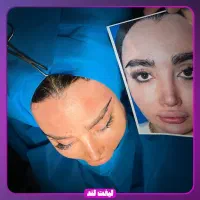 جشنواره تخفیفات جراحی لیفت صورت