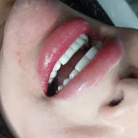 اجرا و اموزش کامپوزیت به صورت تخصصی