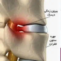 طب سنتی ،رفع بلغم گوارشی .ناف ورودل .رگ هول وغیره|خدمات آرایشگری و زیبایی|اراک, |دیوار