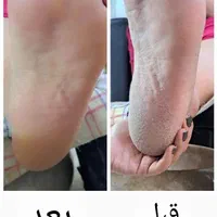 کفسابی وپدیکور همراه با ماساژ پا