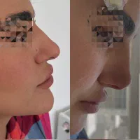 مرکزتخصصی لیفت بانخ و کانتورینگ صورت|خدمات آرایشگری و زیبایی|کرمانشاه, |دیوار