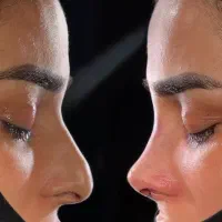 عمل بلفاروپلاستی/عمل بینی/ کاشت ابرو/ کاشت مو|خدمات آرایشگری و زیبایی|اندیشه, اندیشه فاز ۱|دیوار