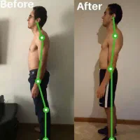 پکیج افزایش قد|آرایشی، بهداشتی، درمانی|سنندج, |دیوار