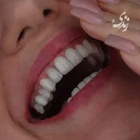 صفرتاصد خدمات دندانپزشکی به صورت اقساطی