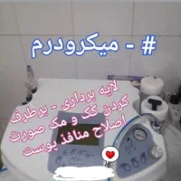 برداشتن خال ، زگیل ، میخچه، جراحی و بوتاکس در مطب