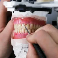 دندانسازی رویان