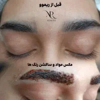 خدمات ریموو تخصصی