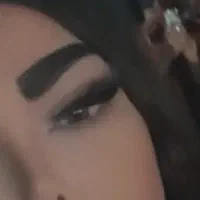 کاشت مژه ۴۵۰