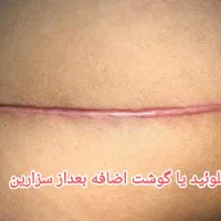 پی بی سرم کانتورینگ|خدمات آرایشگری و زیبایی|رشت, بلوار گیلان|دیوار