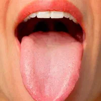 تشخیص دقیق مزاج و وضعیت سلامت از روی زبان
