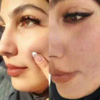 رفع هرگونه لک و جوش و منافذ و چین و چروک