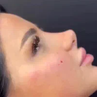عمل جراحی زیبایی بینی،پلک،لیفت صورت،اندام