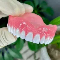 دندان طرح لمینیت