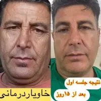 خدمات خاویار تراپی تکنیکی جدید برای مشکلات پوستی|خدمات آرایشگری و زیبایی|شیراز, ریشمک|دیوار