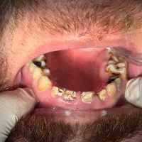 دندانپزشکی دنو|خدمات آرایشگری و زیبایی|دورود, |دیوار