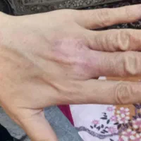 طب سنتی گیاهی ،،بهرامی|آرایشی، بهداشتی، درمانی|ساوه, |دیوار