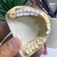 دوره خصوصی آموزش پودرگذاری پروتز ثابت (دندانسازی)