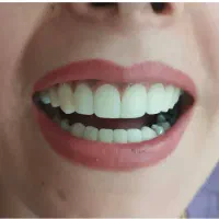 دندون پزشکی و زیبایی