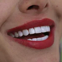 دندانپزشکی.کامپوزیت.روکش دندان.لمینت.ترمیم|خدمات آرایشگری و زیبایی|کرمانشاه, |دیوار