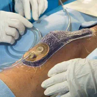 ارائه خدمات تخصصی پرستاری در منزل|خدمات آرایشگری و زیبایی|تهران, مسعودیه|دیوار