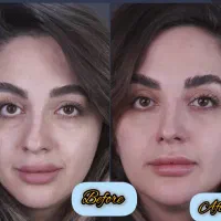 کلینیک تخصصی ژل و بوتاکس|خدمات آرایشگری و زیبایی|شاهین‌شهر, فردوسی|دیوار