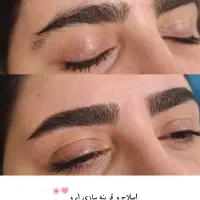 اصلاح اصولی و تخصصی صورت و ابرو