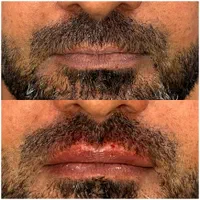 لیزر، ژل،بوتاکس،خال برداری و الکترولیز،لیبیاپلاستی|خدمات آرایشگری و زیبایی|شیراز, پانصد دستگاه ارتش|دیوار