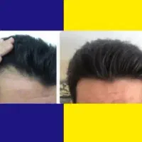 تار موهاتو دوباره میتونی پر قدرت ببینی