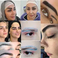 فیلرصورت بوتاکس کربن هایفو لیزرمو ریموتتو جوانسازی|خدمات آرایشگری و زیبایی|یاسوج, |دیوار